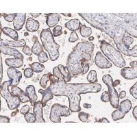 VISTA Rabbit mAb