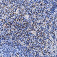 CD8 beta Rabbit mAb