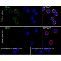 CD33 Rabbit mAb