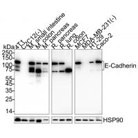 E-Cadherin Rabbit mAb