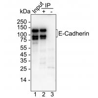 E-Cadherin Rabbit mAb