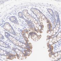 E-Cadherin Rabbit mAb