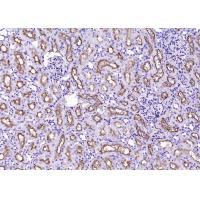 CD13 Rabbit mAb