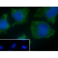 CD13 Rabbit mAb