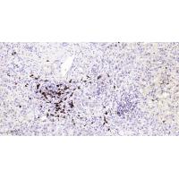CD20 Rabbit mAb