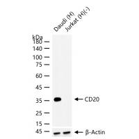 CD20 Rabbit mAb