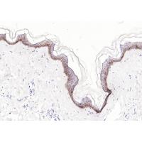 CD1A Rabbit mAb