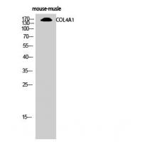 Collagen IV Antibody