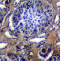 PTPRK Antibody