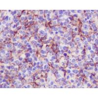 VCAM1 Rabbit mAb