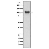VCAM1 Rabbit mAb
