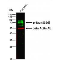 Phospho-Tau(S396) Rabbit mAb