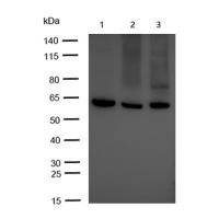 CYP27A1 Rabbit mAb