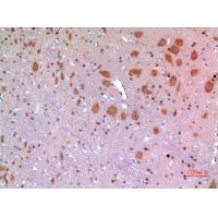 ARP Polyclonal Antibody