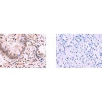 HMGN3 Antibody