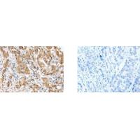 ZNF672 Antibody
