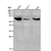 Asparagine Synthetase Rabbit mAb