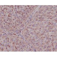 Asparagine Synthetase Rabbit mAb