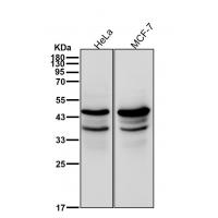 NCK2 Rabbit mAb