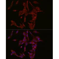 cGAS Rabbit Polyclonal Antibody