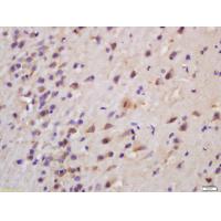 CERS1 Antibody