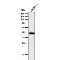 CTSK antibody