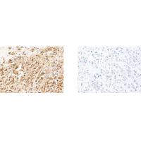 TERF1 antibody