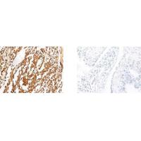 TERF1 antibody