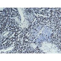 Iba1 Antibody
