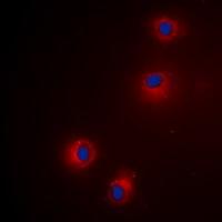 GZMH Antibody