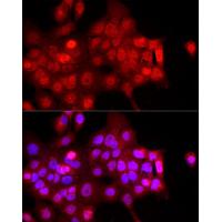 FBXW11 Polyclonal Antibody
