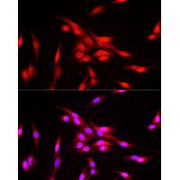FBXW11 Polyclonal Antibody