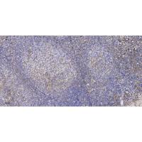 ZFP598 (phospho Tyr306) Polyclonal Antibody