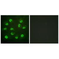 Estrogen Receptor- beta (Phospho-Ser105) Antibody