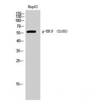 Estrogen Receptor- beta (Phospho-Ser105) Antibody