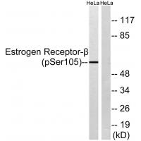 Estrogen Receptor- beta (Phospho-Ser105) Antibody