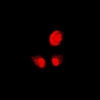 PSMB1 Antibody