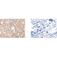 SLC25A4 Antibody