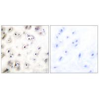 IAPP Antibody