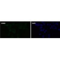 PAK1/PAK2/PAK3(Phospho-S144/S141/S139) Rabbit mAb