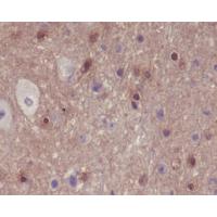 PAK1/PAK2/PAK3(Phospho-S144/S141/S139) Rabbit mAb