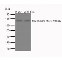 HK2 (Phospho-Thr71) Antibody