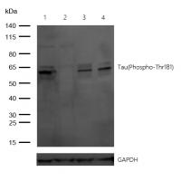 Recombinant Tau(Phospho-Thr181) Rabbit mAb(G69) 
