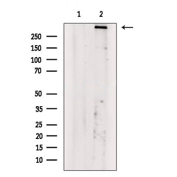 ATM(Phospho-Ser794) Antibody