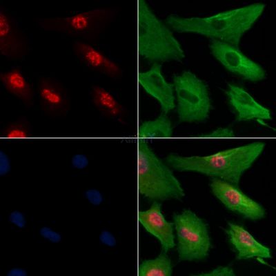 CtIP(Phospho-Thr847)Antibody