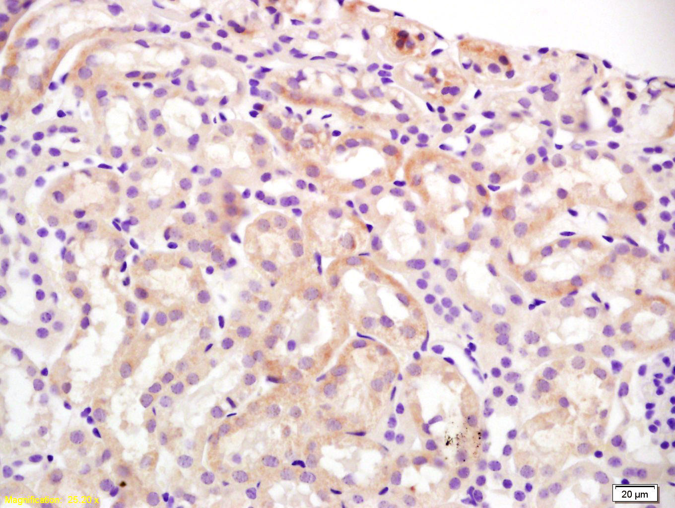 Slco1a1 Antibody