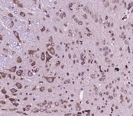 CNR2 Antibody