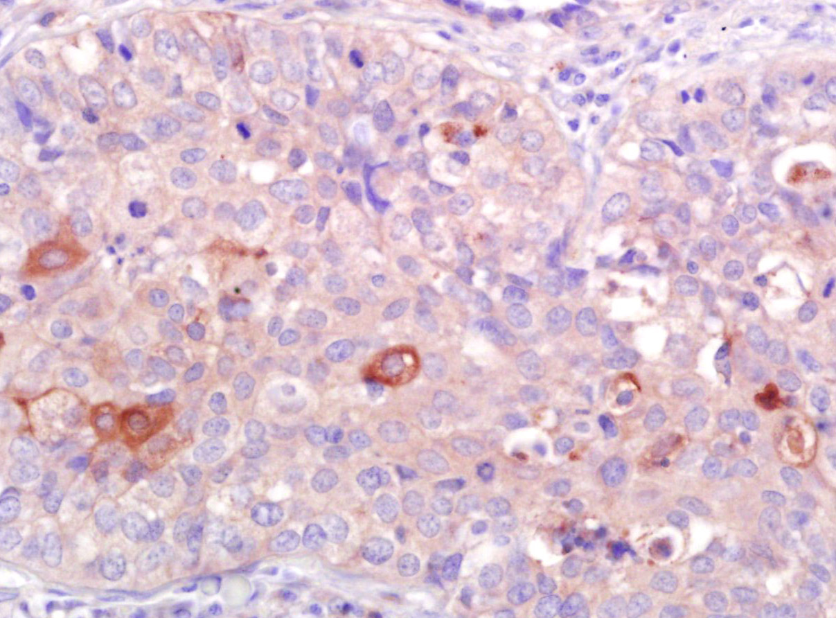 CNR2 Antibody
