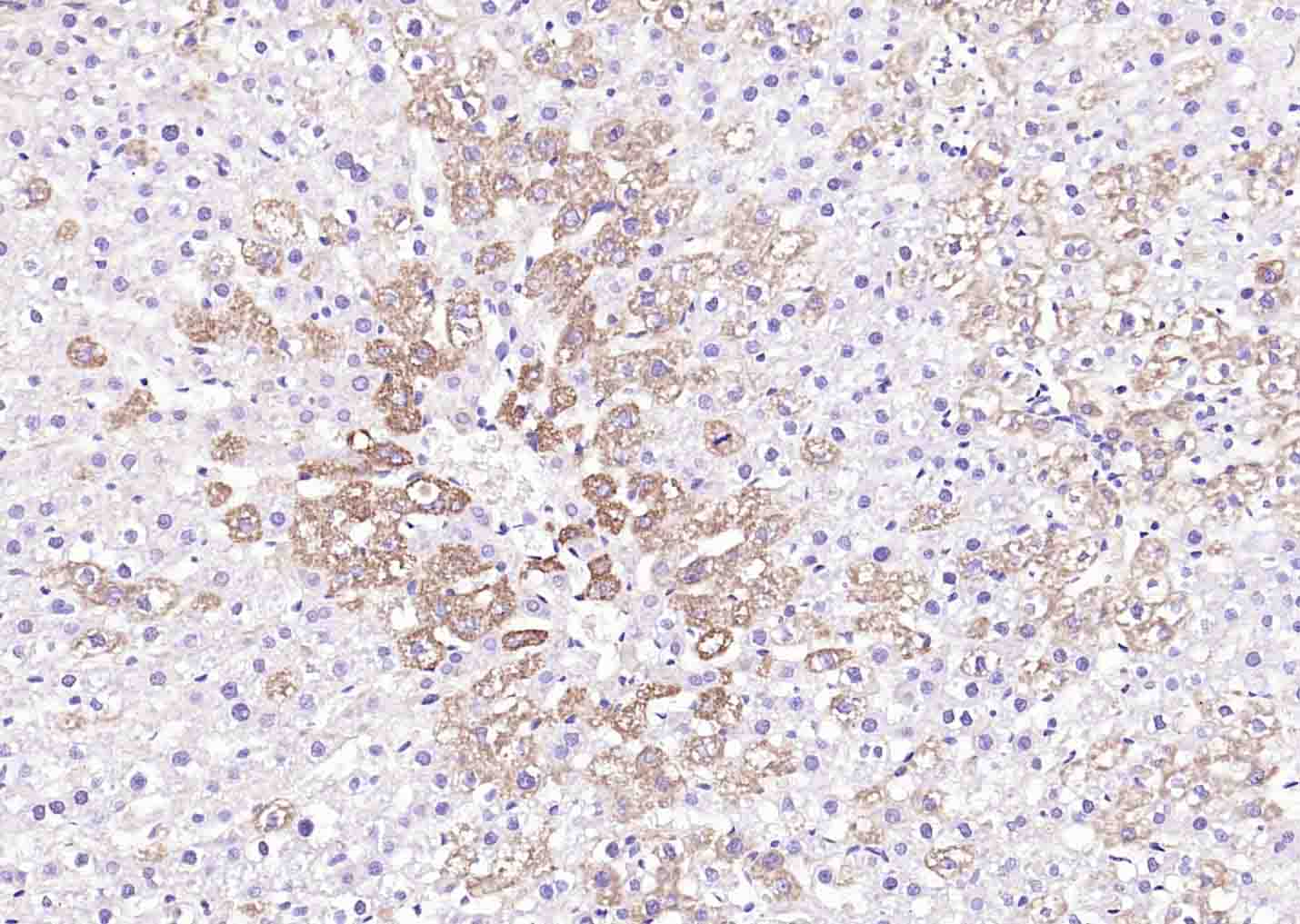 Matriptase 2 antibody