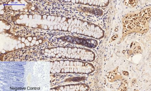 PI 3 kinase p85/p55 (Phospho Tyr467/199) Antibody